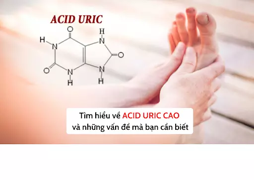 Tìm hiểu về acid uric cao và những vấn đề mà bạn cần biết